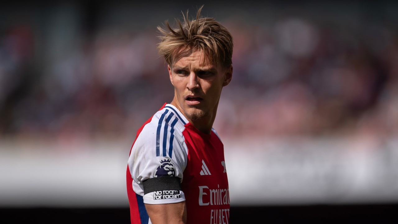 Martin Odegaard offers injury update ahead of Liverpool clash