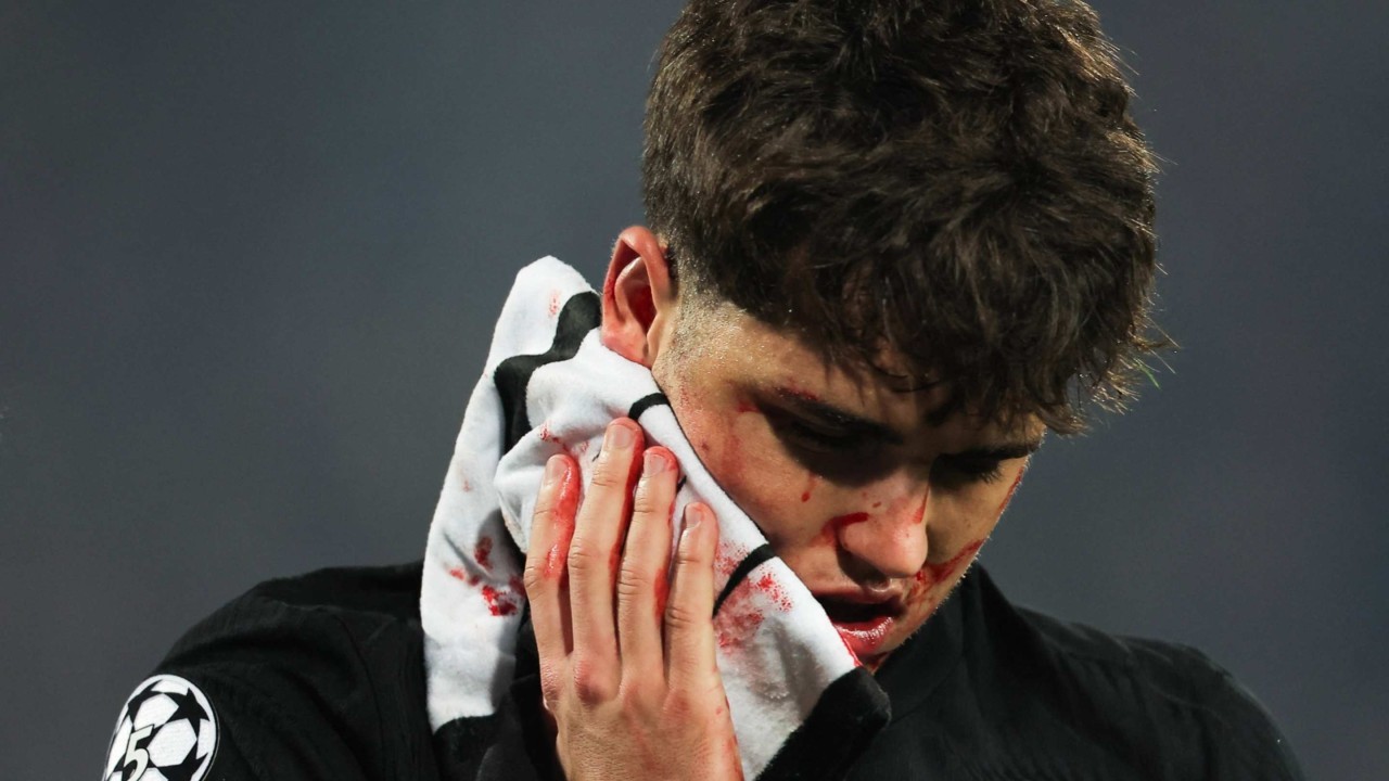 Hansi Flick provides update on Pau Cubarsi's brutal facial injury